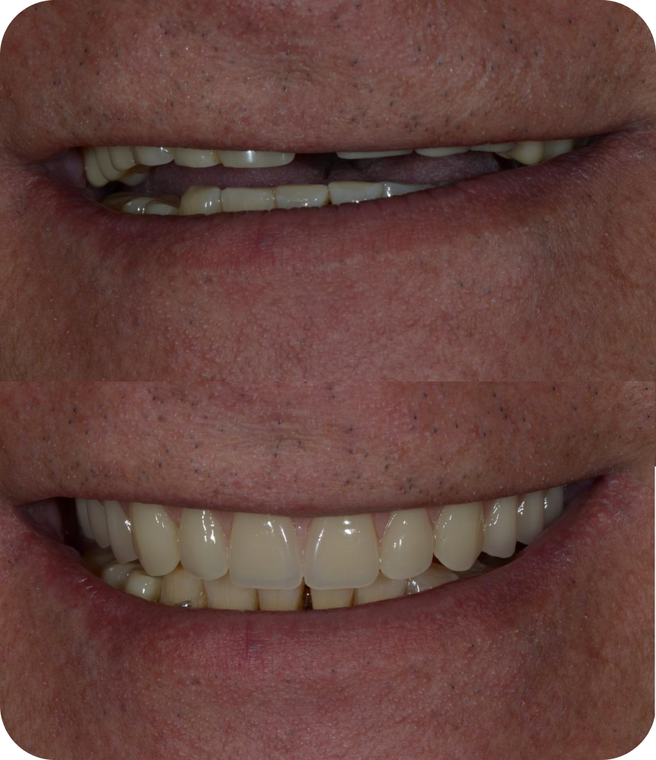 Mask group - 2025-07-02T113730.475