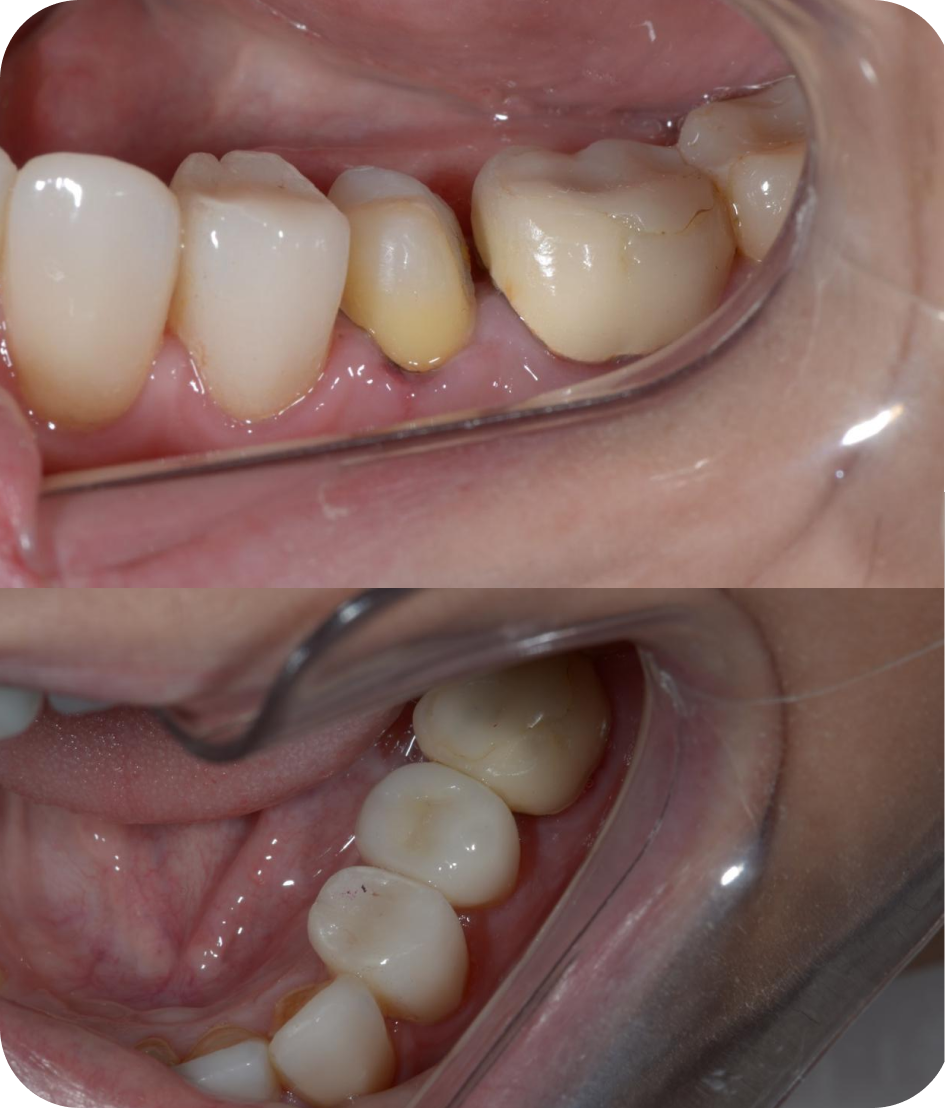 Mask group - 2025-07-02T113736.817